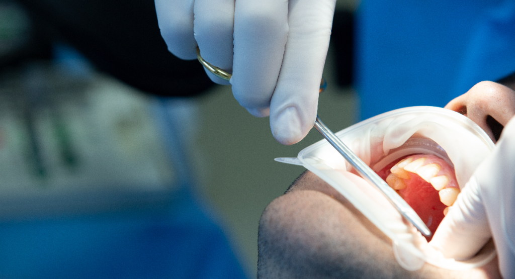 Oral Surgery